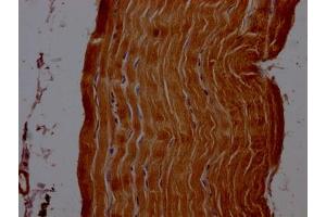 IHC image of ABIN7143815 diluted at 1:200 and staining in paraffin-embedded human skeletal muscle tissue performed on a Leica BondTM system. (ACTN2 抗体  (AA 1-301))