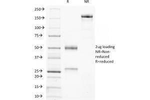 SDS-PAGE Analysis Purified Ku Mouse Monoclonal Antibody (KU729). (XRCC6/XRCC5 抗体)