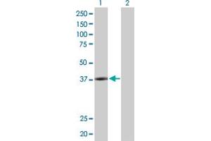 Western Blot analysis of PLA2G15 expression in transfected 293T cell line by PLA2G15 MaxPab polyclonal antibody. (PLA2G15 抗体  (AA 1-412))