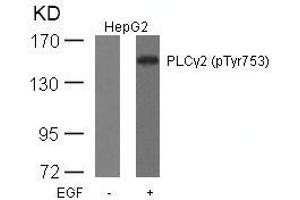 Western blot analysis of extracts from HepG2 cells untreated or treated with EGF using PLCg2(Phospho-Tyr753) Antibody.