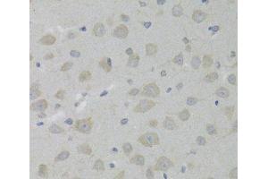 Immunohistochemistry of paraffin-embedded Rat brain using HSD17B13 Polyclonal Antibody at dilution of 1:100 (40x lens). (HSD17B13 抗体)