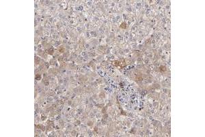Immunohistochemical staining of human liver with FGB polyclonal antibody  shows moderate cytoplasmic positivity in hepatocytes. (Fibrinogen beta Chain 抗体)