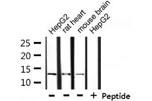 Western blot analysis of extracts from HepG2, rat heart and mouse brain, using NDUFA4L2 Antibody. (NDUFA4L2 抗体  (C-Term))