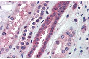 Immunohistochemistry (IHC) image for anti-ATPase, H+ Transporting, Lysosomal V0 Subunit A2 (ATP6V0A2) (N-Term) antibody (ABIN2775376)