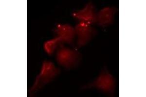 ABIN6275230 staining COLO205 by IF/ICC. (MGST2 抗体  (Internal Region))