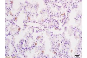 Formalin-fixed and paraffin embedded rat kidney tissue labeled with Anti-Phospho-YB1(Ser102) Polyclonal Antibody, Unconjugated (ABIN746918) at 1:200 followed by conjugation to the secondary antibody and DAB staining (YBX1 抗体  (pSer102))