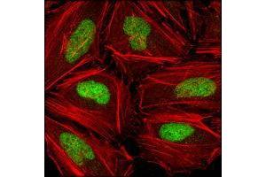 Confocal immunofluorescence analysis of Hela cells using CHK2 mouse mAb (green), showing nuclear localization. (CHEK2 抗体  (AA 481-531))