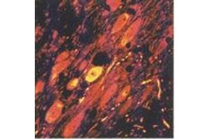 GABAergic neurons in the reticular nucleus of the thalamus (MAb 5A9, GABA) (GABA 抗体)
