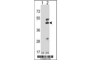 Western blot analysis of Map2k5 using rabbit polyclonal Mouse Map2k5 Antibody using 293 cell lysates (2 ug/lane) either nontransfected (Lane 1) or transiently transfected (Lane 2) with the Map2k5 gene. (MAP2K5 抗体  (C-Term))