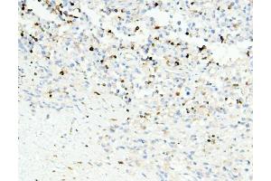 IHC analysis of APOBEC3G using anti-APOBEC3G antibody (ABIN6719444).