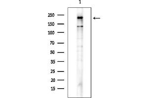 anti-GLI Family Zinc Finger 2 (GLI2) (pSer149) antibody