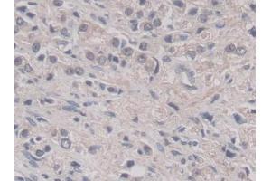 Immunohistochemistry (IHC) image for anti-Pepsinogen C (PGC) (AA 61-388) antibody (ABIN1172498)