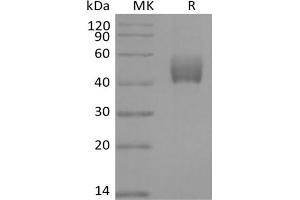 TGFBR1 Protein (Fc Tag)