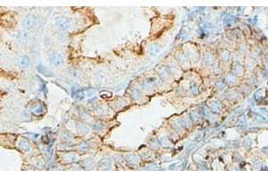 IHC analysis of formalin-fixed paraffin-embedded fetal kidney with cytoplasmic staining, using ACTBL2 antibody (1/100 dilution). (ACTBL2 抗体  (Middle Region))
