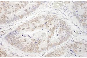 anti-Protein Arginine Methyltransferase 6 (PRMT6) (C-Term) antibody