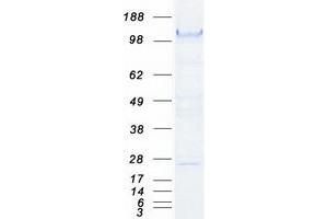 Western Blotting (WB) image for Cadherin 1, Type 1, E-Cadherin (Epithelial) (CDH1) protein (Myc-DYKDDDDK Tag) (ABIN2713653)
