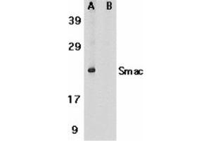 Image no. 2 for anti-Second Mitochondria-Derived Activator of Caspase (DIABLO) (AA 225-239) antibody (ABIN204877) (DIABLO 抗体  (AA 225-239))
