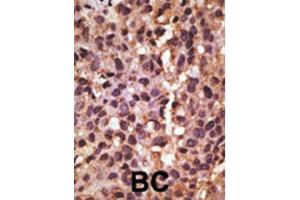 Immunohistochemistry (IHC) image for anti-BCL2/adenovirus E1B 19kDa Interacting Protein 3 (BNIP3) (BH3 Domain) antibody (ABIN2997216) (BNIP3 抗体  (BH3 Domain))