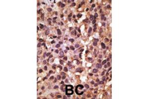 Immunohistochemistry (IHC) image for anti-BCL2/adenovirus E1B 19kDa Interacting Protein 3 (BNIP3) (BH3 Domain) antibody (ABIN2997216) (BNIP3 抗体  (BH3 Domain))