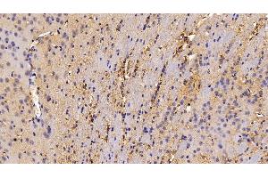 Detection of CAT in Mouse Cerebrum Tissue using Polyclonal Antibody to Catalase (CAT) (Catalase 抗体  (AA 401-523))