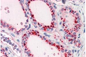Human Thyroid: Formalin-Fixed, Paraffin-Embedded (FFPE) (RYBP 抗体  (N-Term))