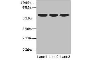 Western blot All lanes: KRT10 antibody at 6 μg/mL Lane 1: A431 whole cell lysate Lane 2: HepG2 whole cell lysate Lane 3: MCF-7 whole cell lysate Secondary Goat polyclonal to rabbit IgG at 1/10000 dilution Predicted band size: 59 kDa Observed band size: 59 kDa (Keratin 10 抗体  (AA 1-584))