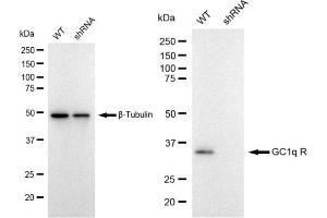 Western blotting analysis using GC1q R antibody (ABIN7798137). (Recombinant C1QBP 抗体)