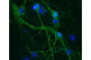 Indirect immunostaining of PFA fixed rat hippocampus neurons (dilution 1 : 500; green). (SNAP25 抗体  (AA 192-206))