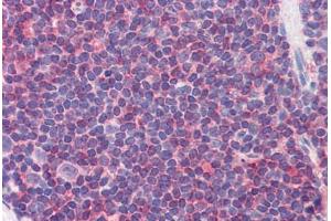 Human Colon, MALT (formalin-fixed, paraffin-embedded) stained with IL7R antibody ABIN351553 at 5 ug/ml followed by biotinylated goat anti-rabbit IgG secondary antibody ABIN481713, alkaline phosphatase-streptavidin and chromogen. (IL7R 抗体  (pTyr449))