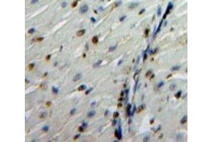 IHC-P analysis of Heart tissue, with DAB staining. (Glucocorticoid Receptor 抗体  (AA 532-730))