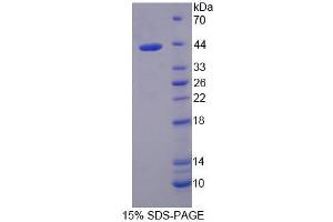 SDS-PAGE analysis of Mouse TIF1b Protein. (KAP1 蛋白)