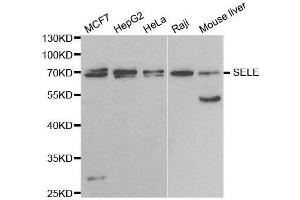 Western blot analysis of extracts of various cell lines, using SELE antibody. (Selectin E/CD62e 抗体  (AA 22-230))