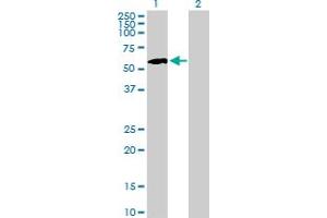 Western Blot analysis of IP6K1 expression in transfected 293T cell line by IP6K1 MaxPab polyclonal antibody. (IP6K1 抗体  (AA 1-441))