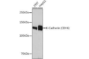 Western blot analysis of extracts of various cell lines, using K-Cadherin (CDH6) Rabbit mAb (ABIN1680831, ABIN3019147, ABIN3019148 and ABIN7101722) at 1:3000 dilution. (CDH6 抗体)