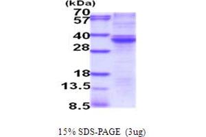 SDS-PAGE (SDS) image for RASD Family, Member 2 (RASD2) (AA 1-266) protein (His tag) (ABIN5854088)