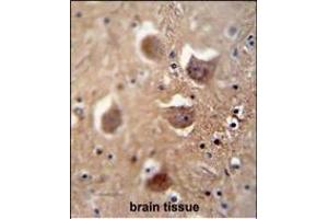 Immunohistochemistry (Paraffin-embedded Sections) (IHC (p)) image for anti-Tudor Domain Containing 7 (TDRD7) (AA 807-835), (C-Term) antibody (ABIN654935)