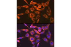 Immunofluorescence analysis of NIH-3T3 cells using IMPDH2 Rabbit mAb  at dilution of 1:100 (40x lens). (IMPDH2 抗体)