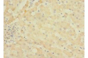 Immunohistochemistry of paraffin-embedded human liver tissue using ABIN7144737 at dilution of 1:100 (ASPHD1 抗体  (AA 96-390))
