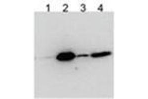 HEK293 overexpressing Human BICC1 with N-terminal FLAG, probed with Rabbit anti-BCC1 in Western Blot after IP using either AP31787PU-N or anti-FLAG antibody in the presence or absence of SDS. (BICC1 抗体  (Internal Region))