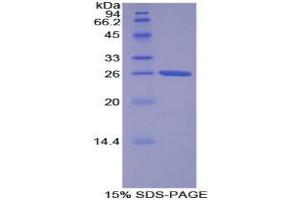 SDS-PAGE analysis of Human Torsin 2A Protein. (TOR2A 蛋白)