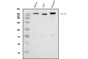 Western blot analysis of IGF2R using anti-IGF2R antibody (ABIN7601705).