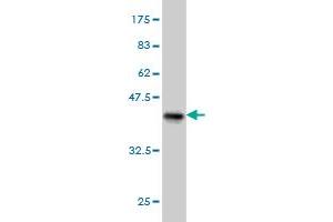 Western Blot detection against Immunogen (37. (PDHB 抗体  (AA 250-359))