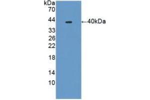 Detection of Recombinant PLA2R1, Mouse using Polyclonal Antibody to Phospholipase A2 Receptor 1 (PLA2R1) (PLA2R1 抗体  (AA 1418-1487))