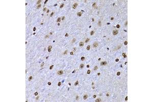 Immunohistochemistry of paraffin-embedded mouse brain using SOX5 antibody. (SOX5 抗体  (AA 1-120))