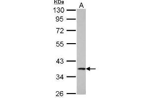 WB Image Cathepsin S antibody detects CTSS protein by Western blot analysis. (Cathepsin S 抗体)