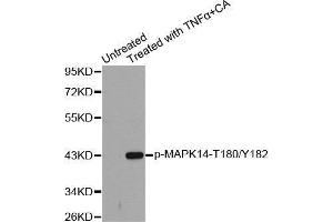 Western blot analysis of extracts from Hela cells using Phospho-MAPK14-T180/Y182 antibody. (MAPK14 抗体  (pThr180, pTyr182))