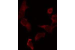 ABIN6275344 staining 293 by IF/ICC. (PECI/ECI2 抗体  (Internal Region))