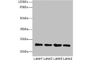 Western blot All lanes: HPCAL4 antibody at 2 μg/mL Lane 1: Mouse brain tissue Lane 2: Mouse kidney tissue Lane 3: Mouse ovarian tissue Lane 4: Human placenta tissue Secondary Goat polyclonal to rabbit IgG at 1/10000 dilution Predicted band size: 22 kDa Observed band size: 22 kDa (HPCAL4 抗体  (AA 2-191))