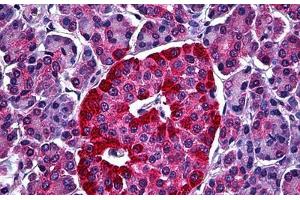 Human Pancreas, Islets of Langerhans: Formalin-Fixed, Paraffin-Embedded (FFPE) (STXBP1 抗体  (AA 74-169))