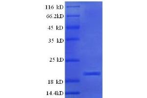 Protein expressed in E. (Ephrin A5 Protein (EFNA5) (AA 21-203, full length) (His tag))